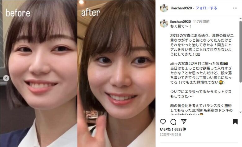 引用元:いけちゃんInstagram