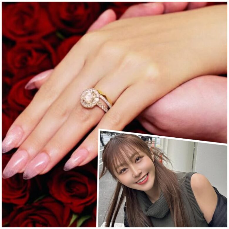 てんちむの結婚指輪の画像