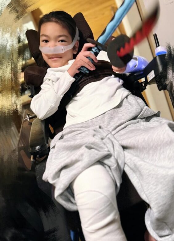 星野真里の子供・ふうかさんの怪我画像
